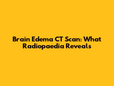 Brain Edema CT Scan: What Radiopaedia Reveals