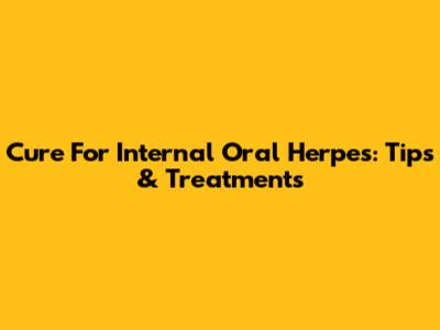 Cure For Internal Oral Herpes: Tips & Treatments