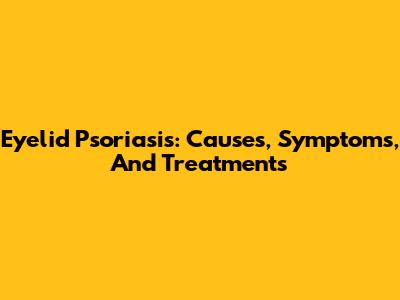 Eyelid Psoriasis: Causes, Symptoms, And Treatments