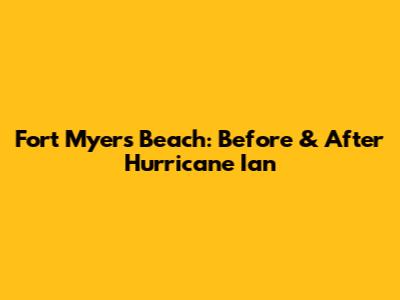 Fort Myers Beach: Before & After Hurricane Ian