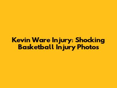 Kevin Ware Injury: Shocking Basketball Injury Photos