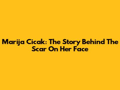 Marija Cicak: The Story Behind The Scar On Her Face