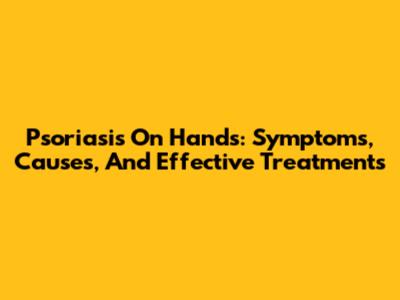 Psoriasis On Hands: Symptoms, Causes, And Effective Treatments