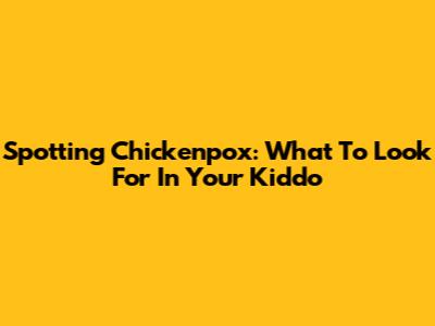 Spotting Chickenpox: What To Look For In Your Kiddo